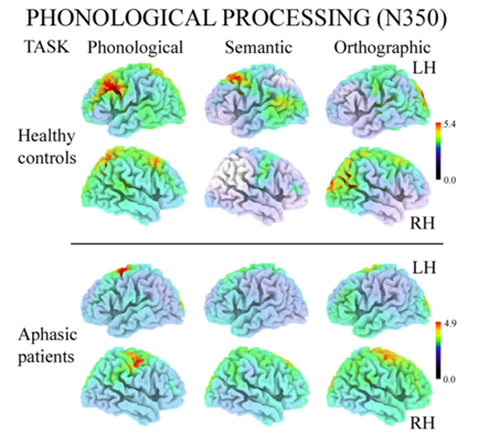 Cortical reorganization